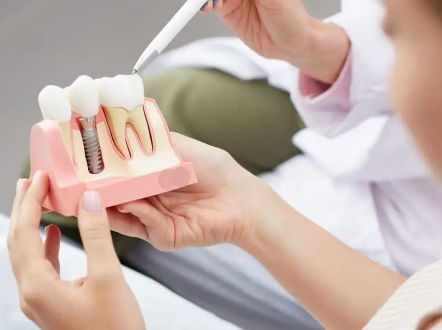 Dentista de Implante em Valinhos