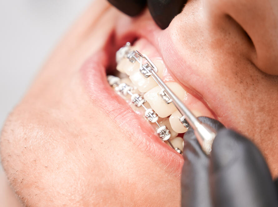 Ortodontista em Valinhos