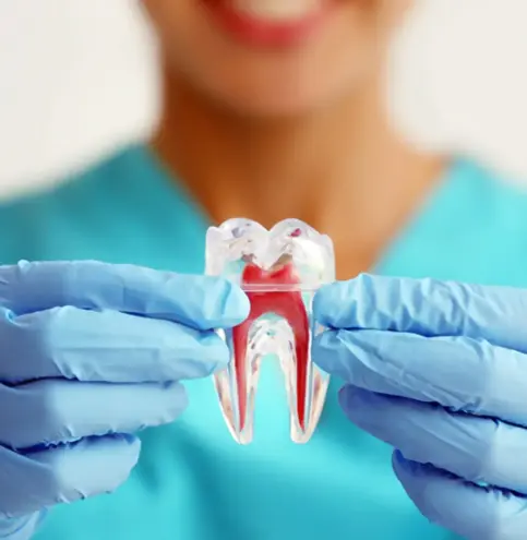 endodontia-tratamento-de-canal-em-valinhos